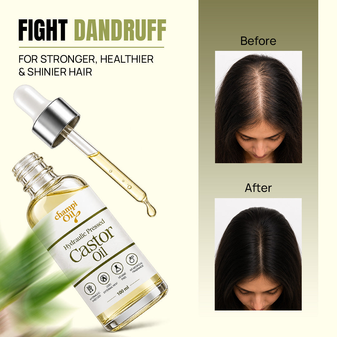 Champi Oil Organic Castor Oil for dry flaky scalp and dandruff care