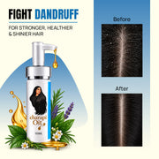 EXO - Dandruff Treatment Oil